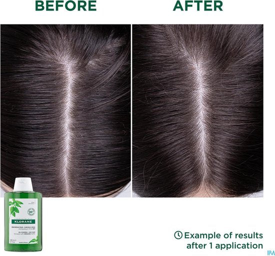 Klorane Haar Ortie Ortie/Brandnetel Shampoo Vet Haar 200ml